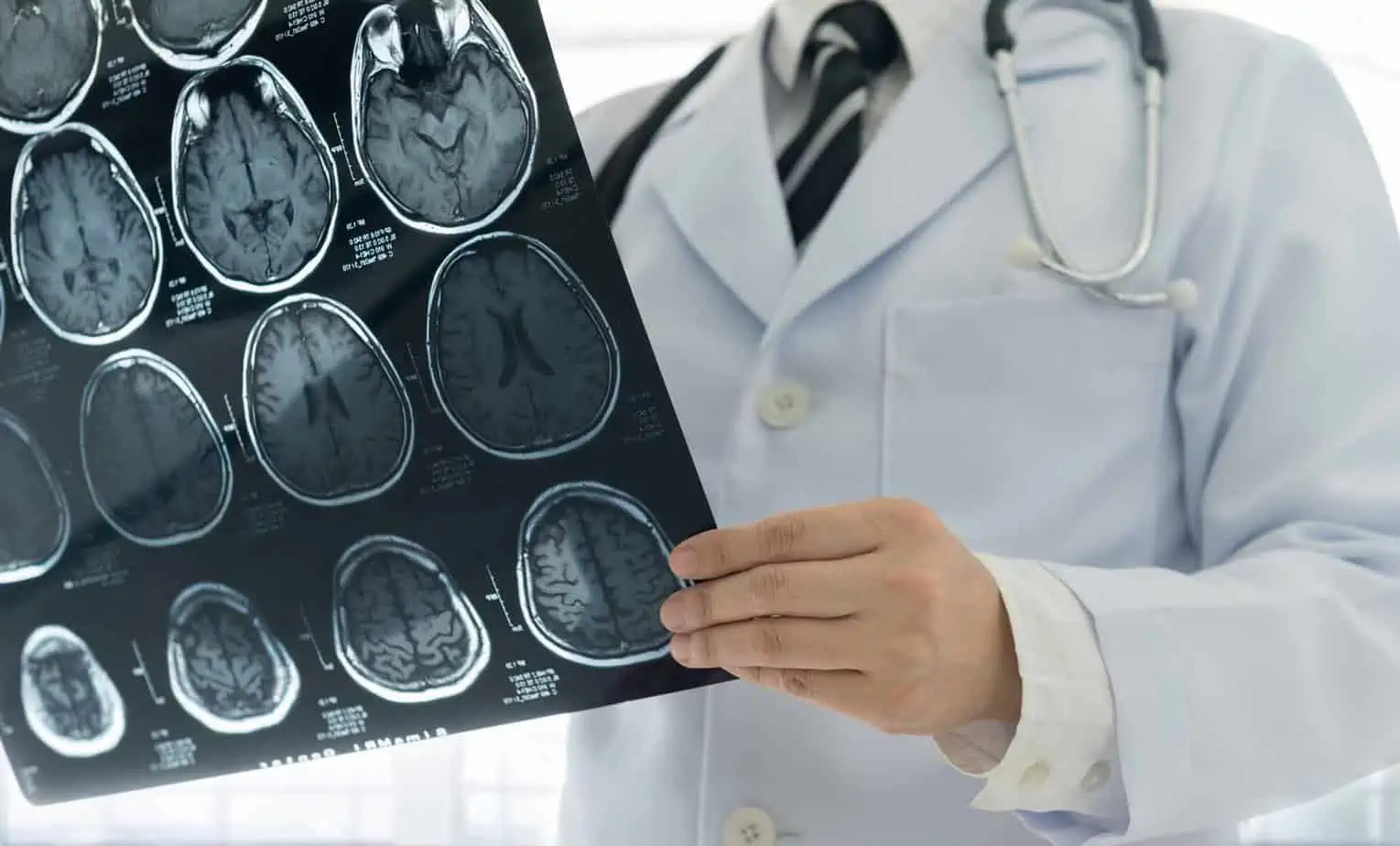 Doctor with X-rays educates how addiction affects the brain at Mountainside Treatment Center